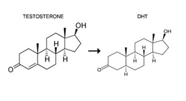 Hair Loss Miracle Solution